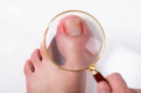 What Causes an Ingrown Toenail to Become Infected?